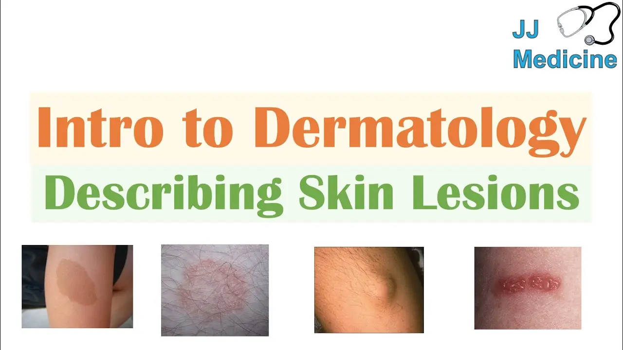 Dermatology &#8211; what does it do? Skin lesions and diseases