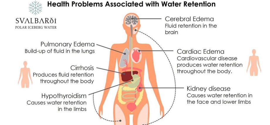 Detocell Aqua &#8211; indications, contraindications, supplement dosage for water retention in the body