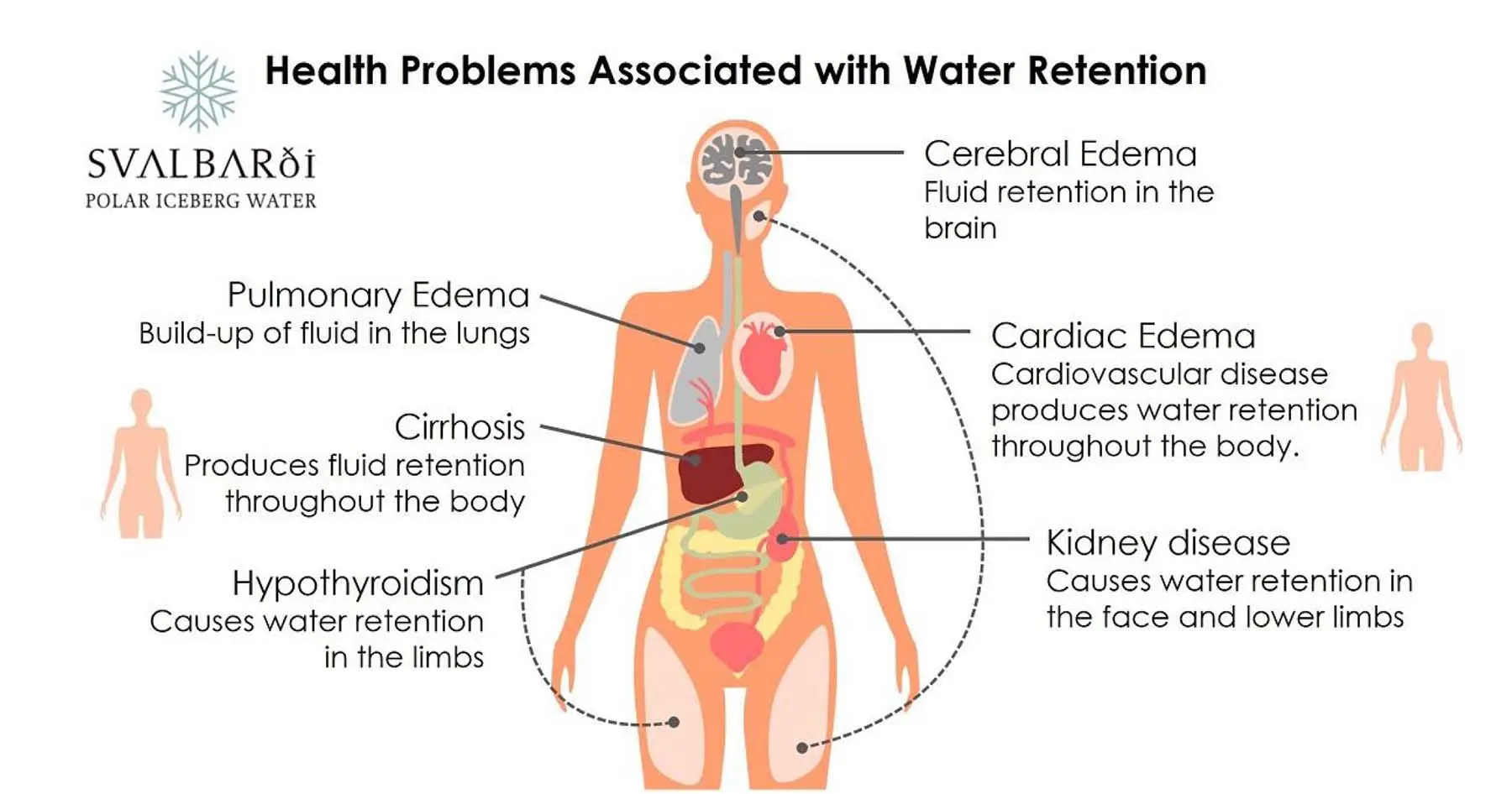 Detocell Aqua &#8211; indications, contraindications, supplement dosage for water retention in the body