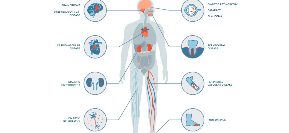 Diabetes complications &#8211; cardiological, renal, ophthalmic, nervous system