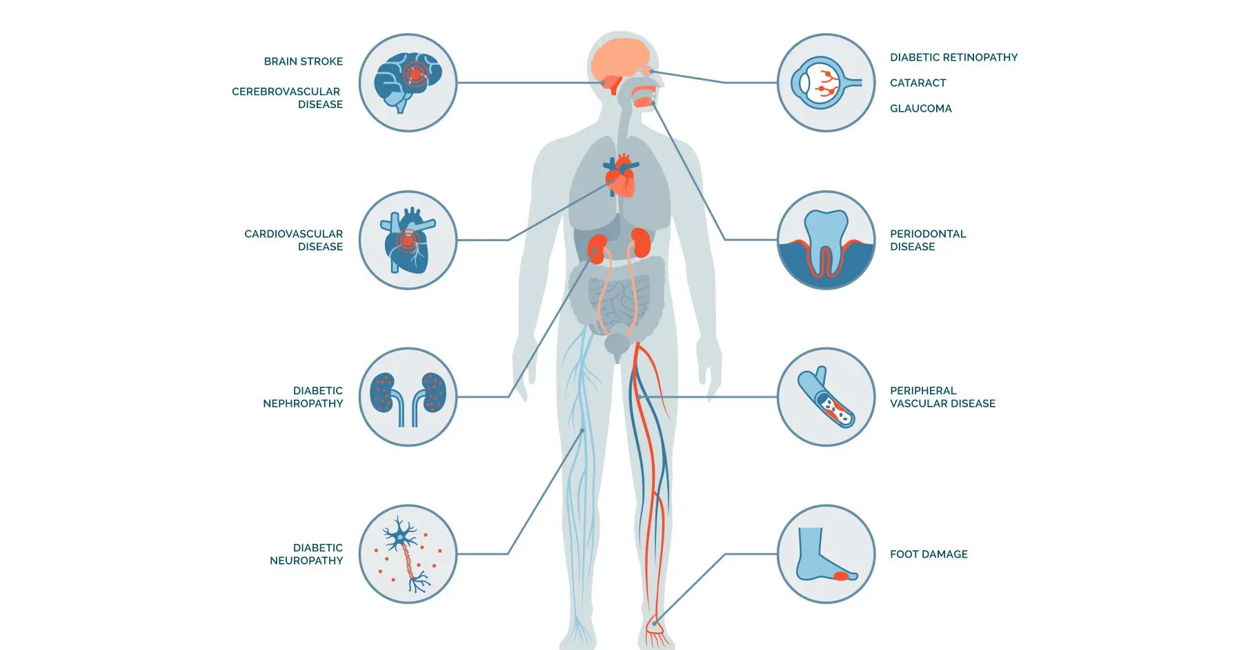 Diabetes complications &#8211; cardiological, renal, ophthalmic, nervous system