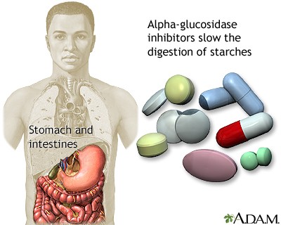 Diabetes: Doesn&#8217;t hurt, but it kills