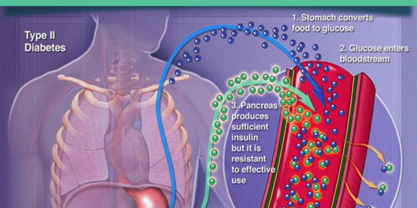 Diabetes, hypertension, garlands. These diseases worsen in heat, doctors warn