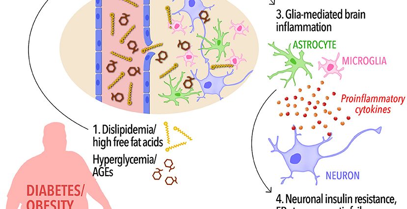 Diabetes is a major risk factor for Alzheimer&#8217;s. What is happening in the patient&#8217;s brain?