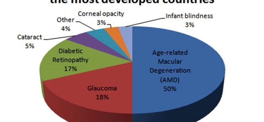 Diabetes is the most common cause of blindness