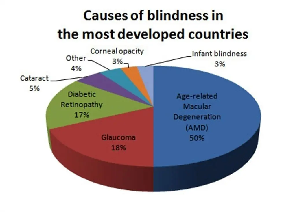 Diabetes is the most common cause of blindness