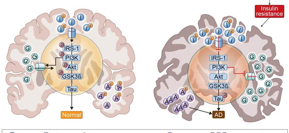 Diabetes medication can undo brain damage from Alzheimer&#8217;s disease