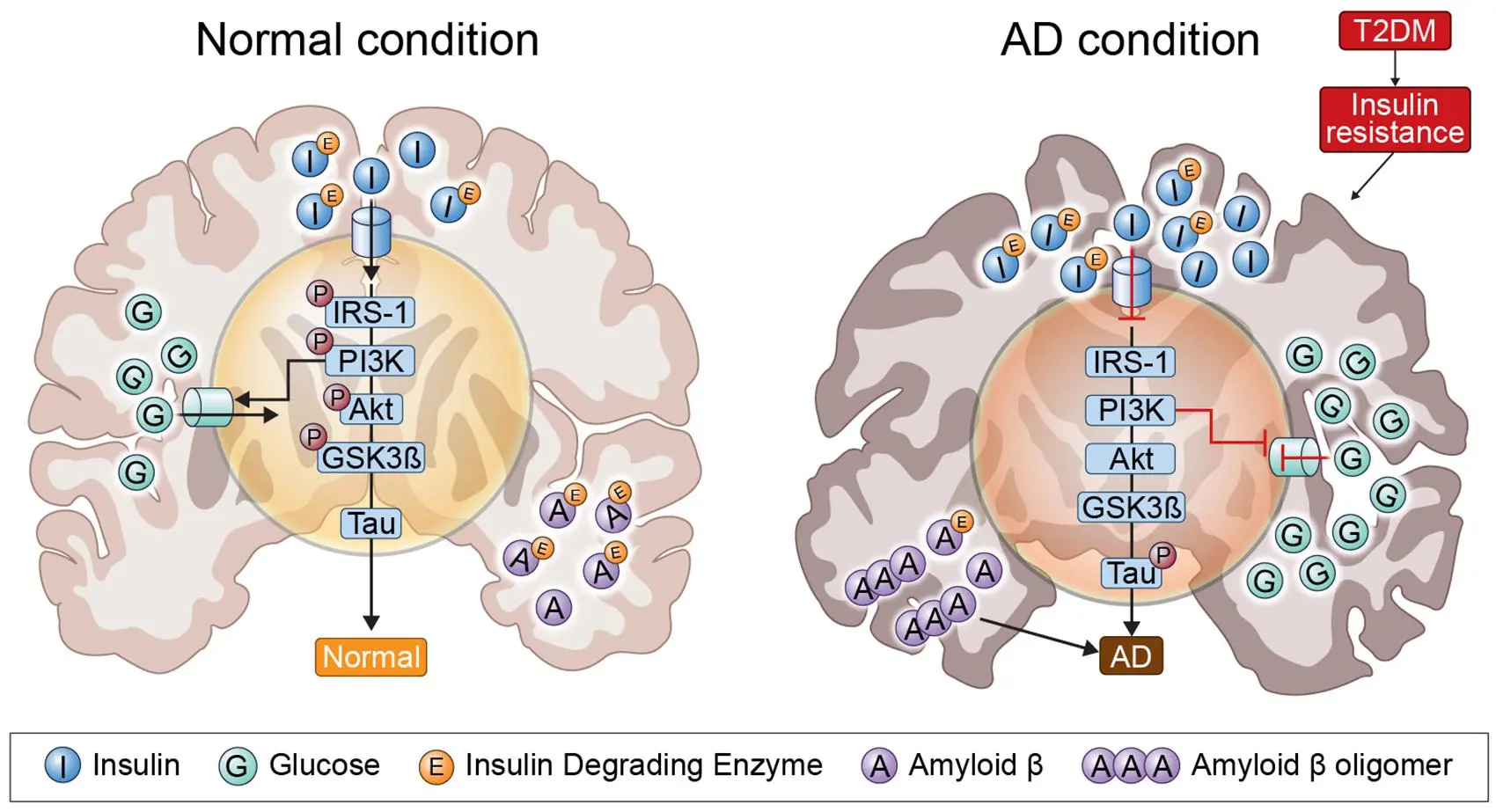 Diabetes medication can undo brain damage from Alzheimer&#8217;s disease