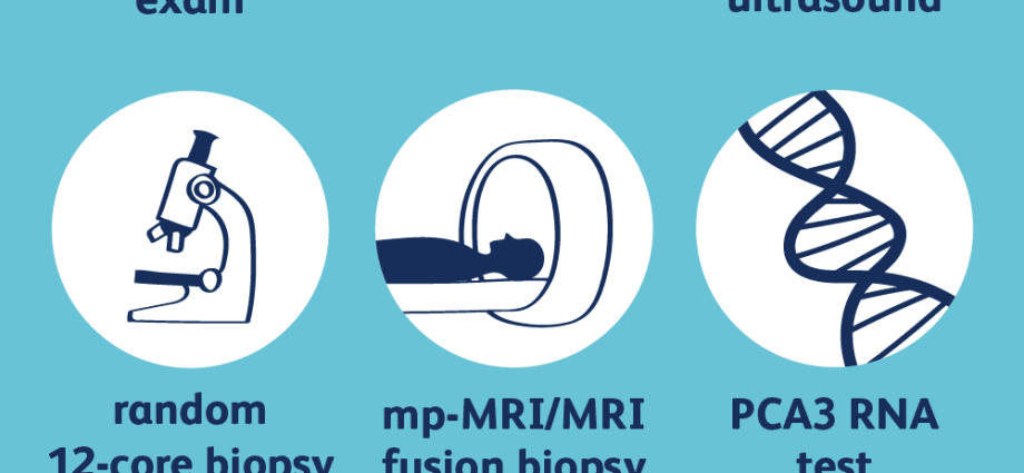 Diagnostics of a patient with prostate cancer &#8211; what is it like step by step?