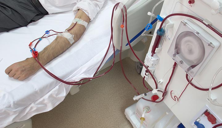 Dialysis &#8211; what is it and who needs it?