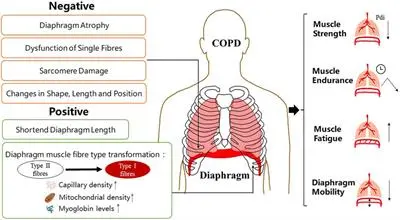 Diaphragm as an independent muscle