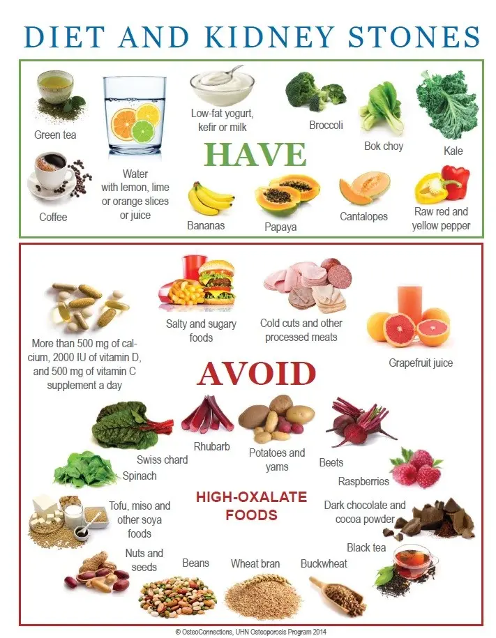 Diet for kidney stones