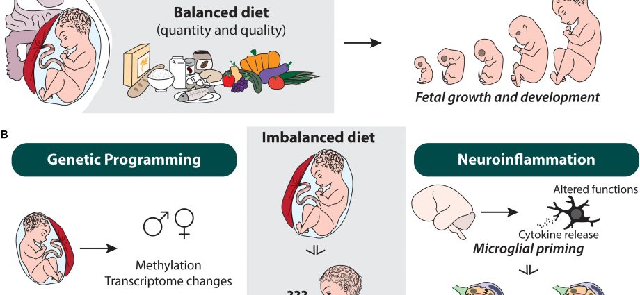 Diet restriction in early pregnancy disrupts the development of the fetal brain