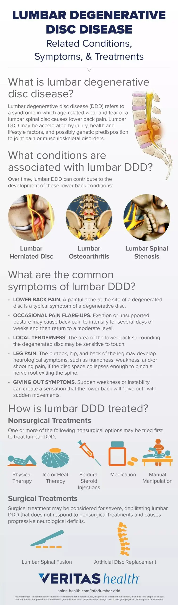 Disc Loss &#8211; Causes, Symptoms, Treatment