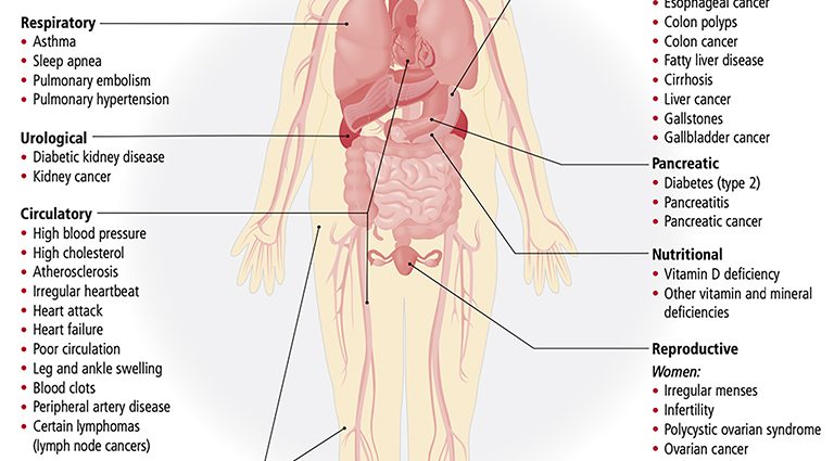 Diseases leading to excess weight