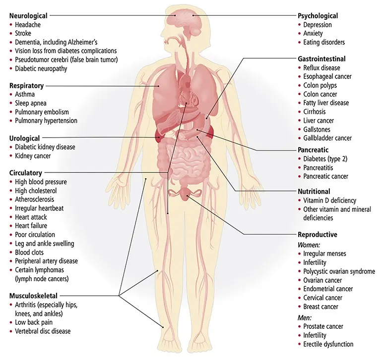 Diseases leading to excess weight