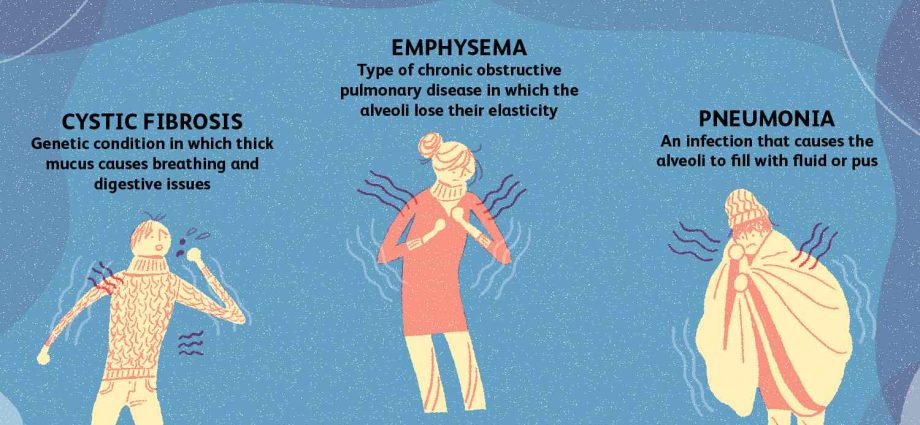 Diseases of the respiratory system that most often affect children