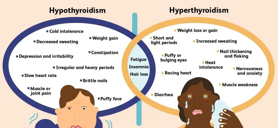 Diseases of the thyroid gland &#8211; hyperthyroidism, hypothyroidism