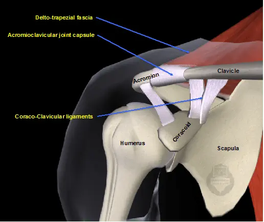 Dislocation of the shoulder-clavicular joint