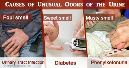 Disturbing smell of urine &#8211; what diseases does it indicate?