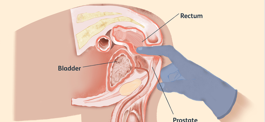 Do you care for your prostate properly? Check!