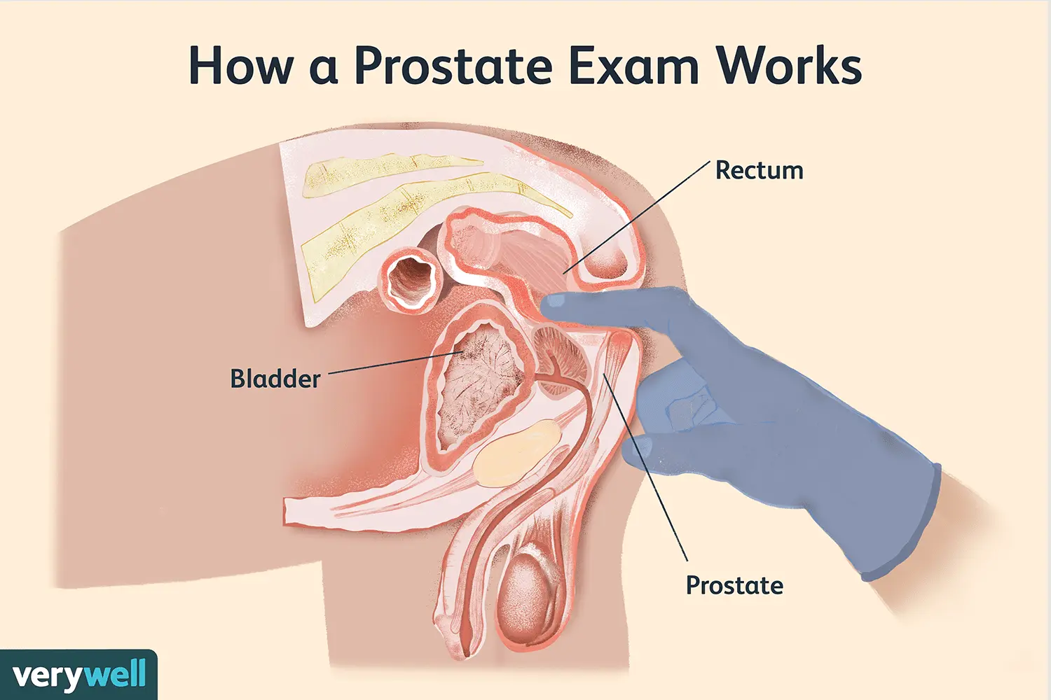 Do you care for your prostate properly? Check!