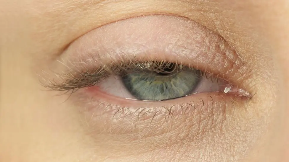 Do you have bags under your eyes? The body is trying to tell you something important