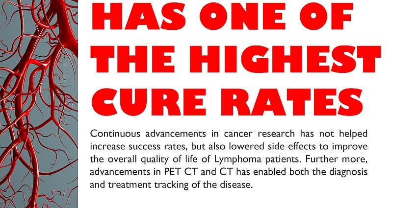 Doctors: 90% patients with Hodgkin&#8217;s lymphoma can be cured