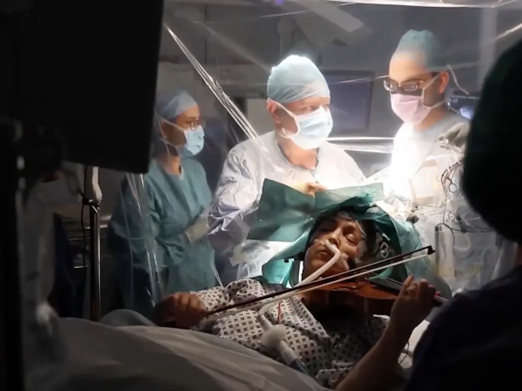 Doctors removed a brain tumor and the patient played the violin. Incredible operation