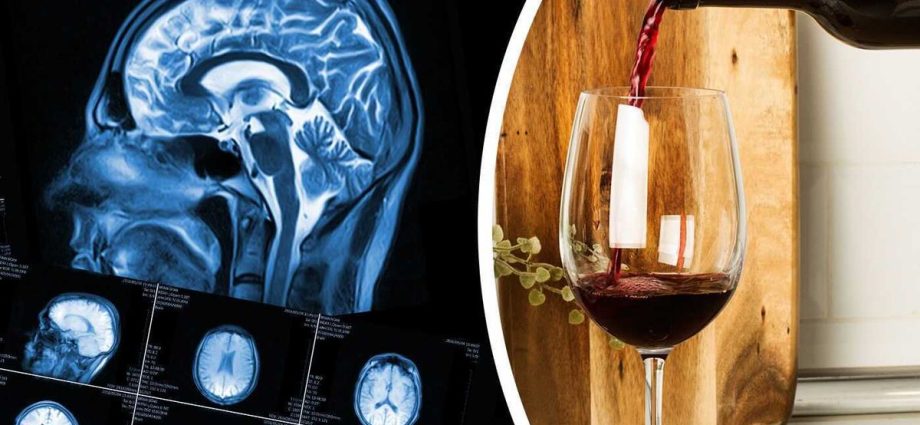 Doctors warn: drinking alcohol before the age of 21 permanently damages the brain