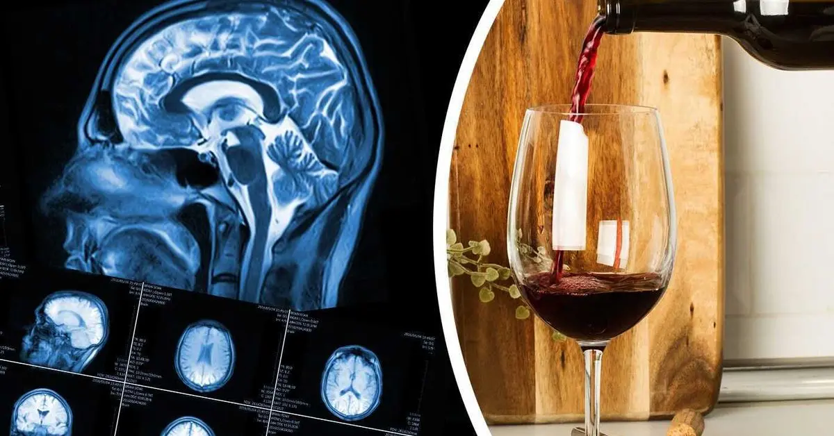 Doctors warn: drinking alcohol before the age of 21 permanently damages the brain