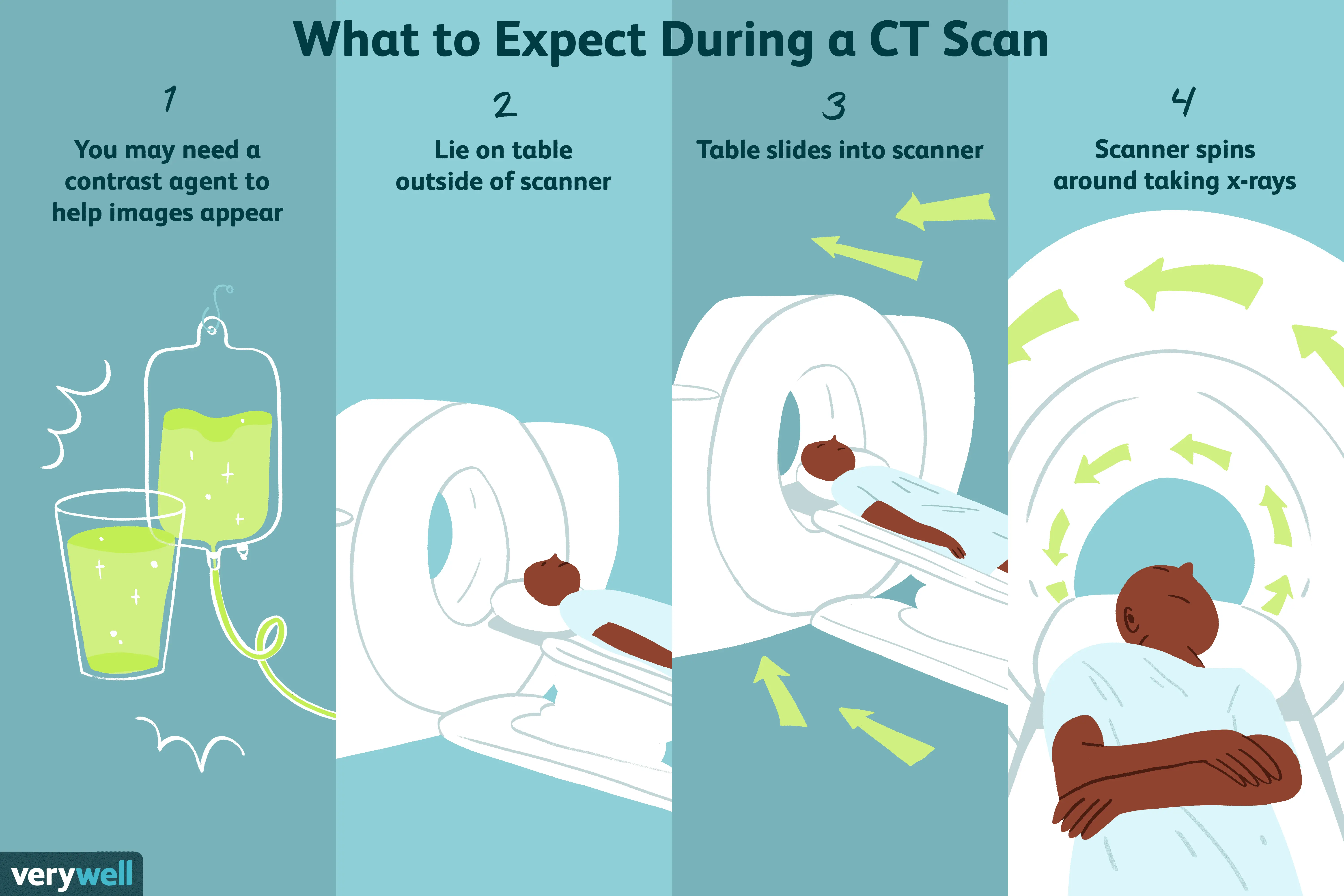 Does contrast tomography have side effects?