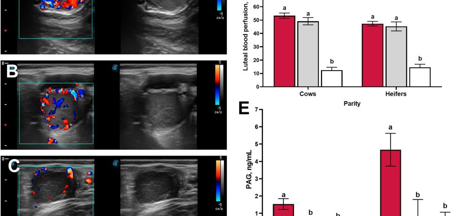 Doppler ultrasound &#8211; indications, preparation for the examination, course