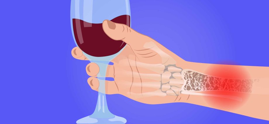 Drinking alcohol protects against serious joint diseases