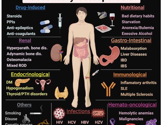 Drug-induced osteoporosis, i.e. the side effects of taking steroids