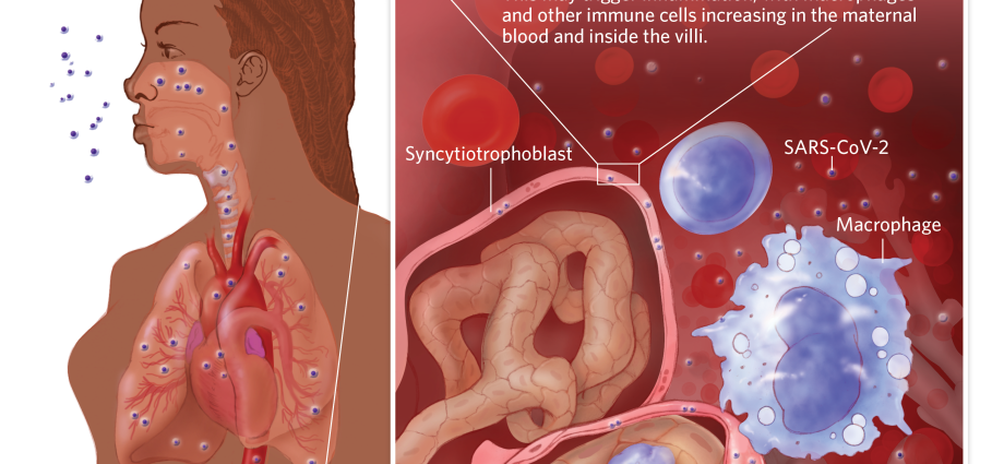 During her period, she coughed up blood. A second uterus was growing in her lungs