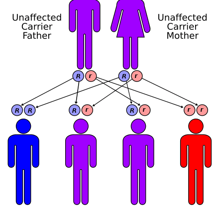 Dwarf syndrome &#8211; how common is it? Donohue syndrome diagnosis and treatment