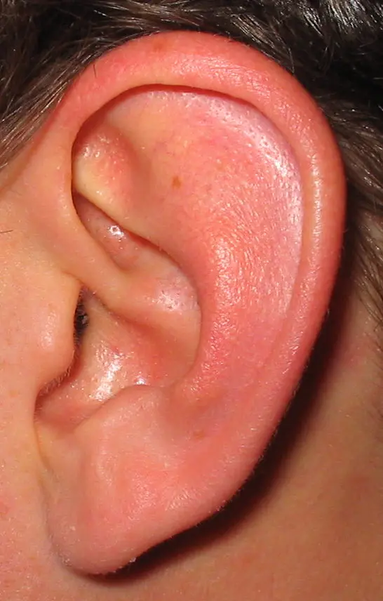 Ear boil