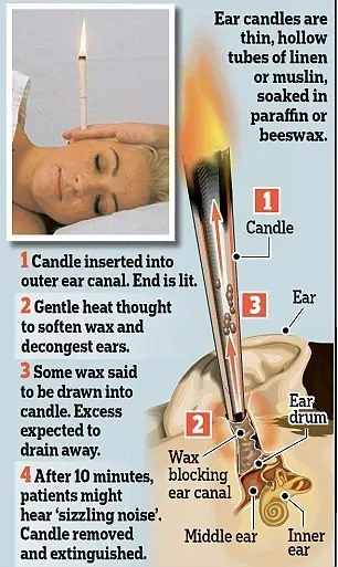 Ear candling &#8211; what is it? Indications for ear candling