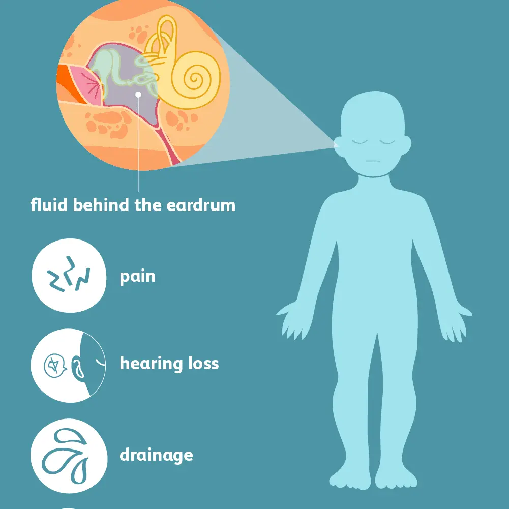 Ear pain in a child &#8211; what to do? Symptoms of earache in a child