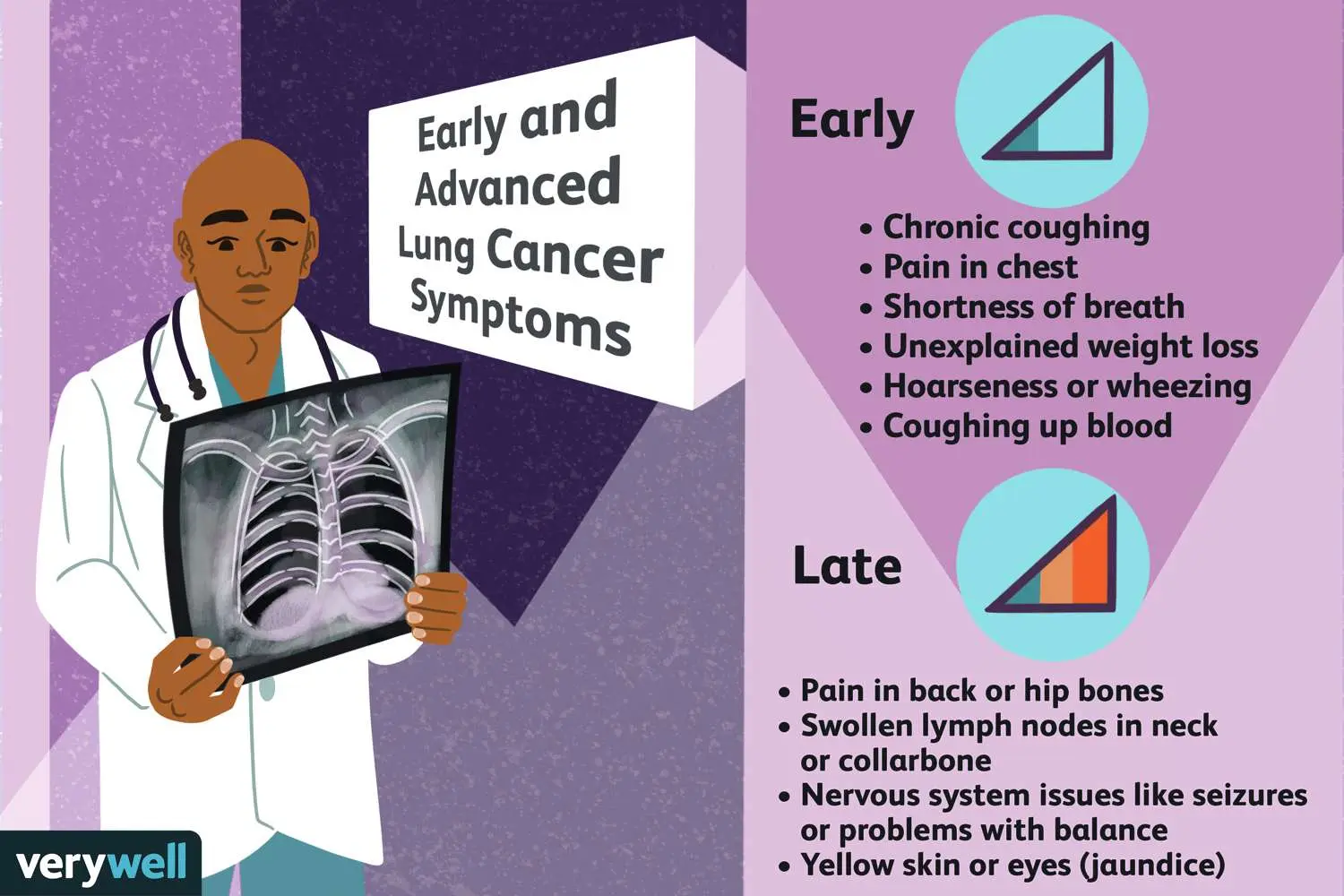 Early detection of lung cancer can save the patient&#8217;s life