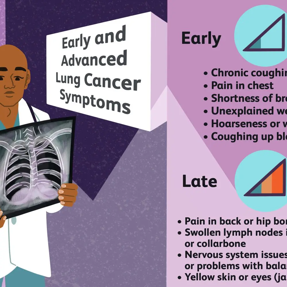 Early symptoms of lung cancer in women. These signals are easy to overlook