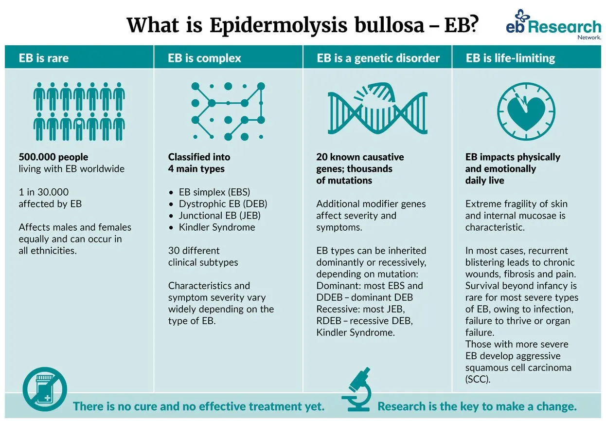 EB disease &#8211; types, symptoms, treatment, inheritance