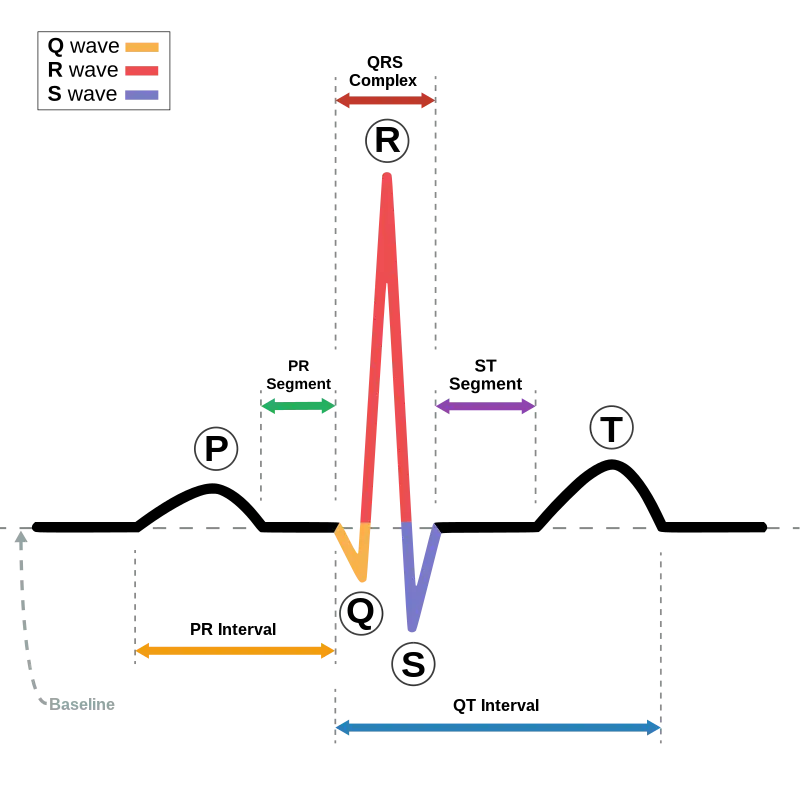 ECG — electrocardiogram