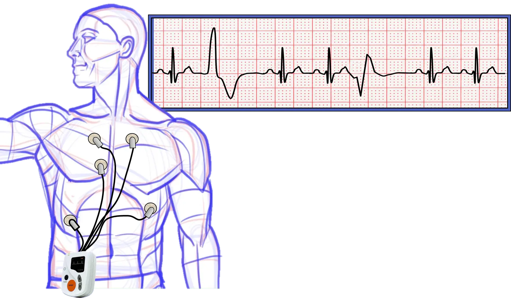 ECG recorder &#8211; indications, course, interpretation of results. How to prepare for a Holter EKG?