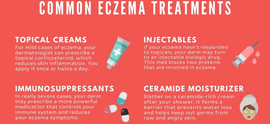 Eczema &#8211; causes, symptoms, treatment