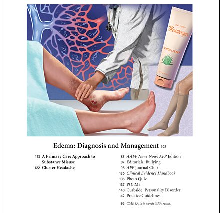 Edema: how they arise and what they testify to