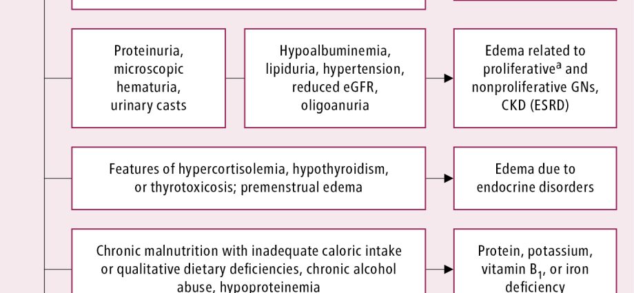 Edema of renal origin &#8211; types, diagnosis, treatment