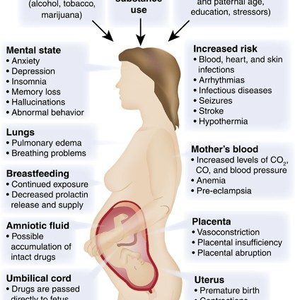 Effects of drugs on the fetus