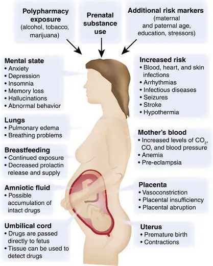 Effects of drugs on the fetus